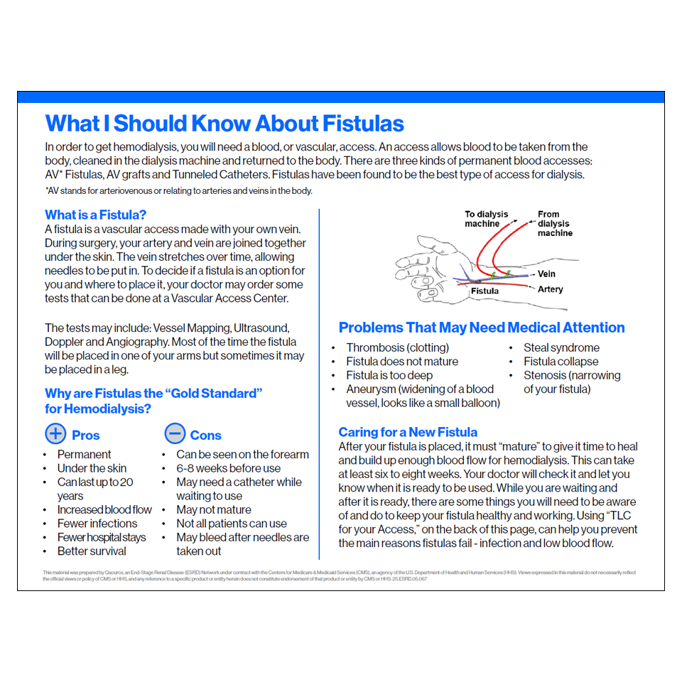 what i should know about fistulas